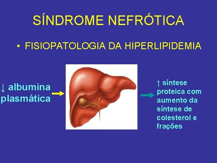 SÍNDROME NEFRÓTICA • FISIOPATOLOGIA DA HIPERLIPIDEMIA ↓ albumina plasmática ↑ síntese proteica com aumento