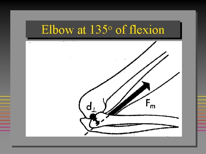 Elbow at 135 o of flexion 