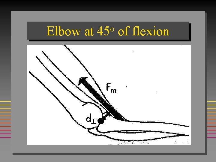 Elbow at 45 o of flexion 