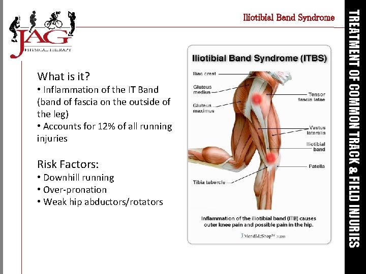 What is it? • Inflammation of the IT Band (band of fascia on the