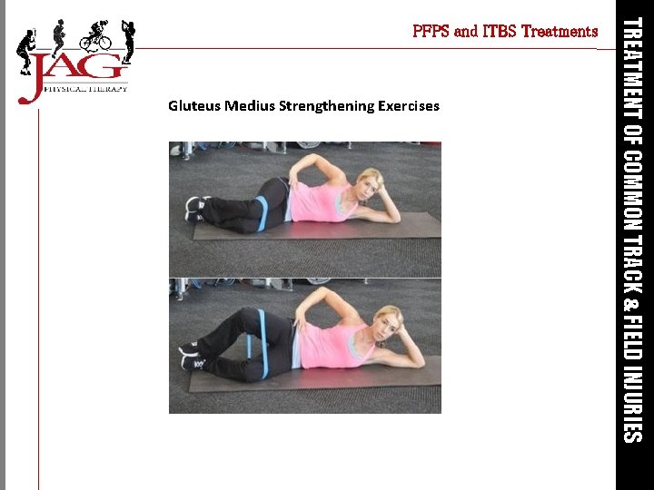 Gluteus Medius Strengthening Exercises TREATMENT OF COMMON TRACK & FIELD INJURIES PFPS and ITBS