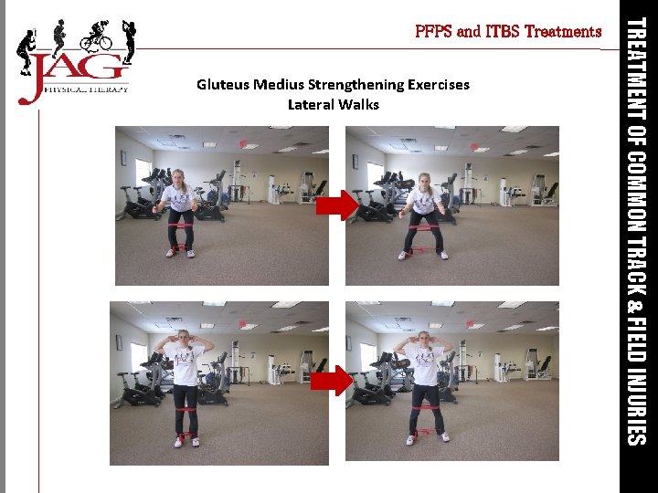 Gluteus Medius Strengthening Exercises Lateral Walks TREATMENT OF COMMON TRACK & FIELD INJURIES PFPS