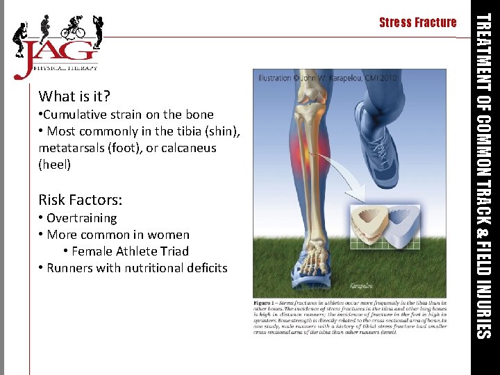 What is it? • Cumulative strain on the bone • Most commonly in the