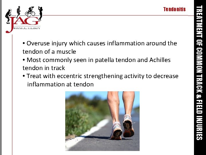  • Overuse injury which causes inflammation around the tendon of a muscle •