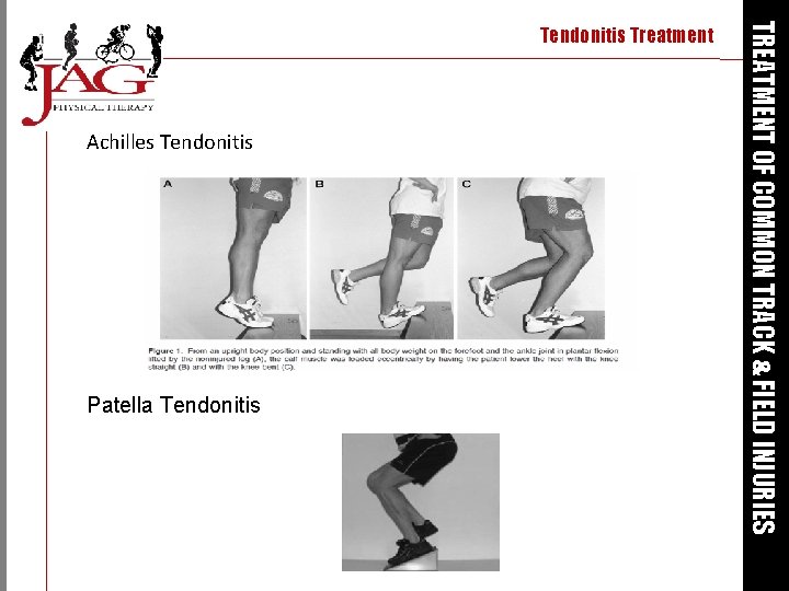 Achilles Tendonitis Patella Tendonitis TREATMENT OF COMMON TRACK & FIELD INJURIES Tendonitis Treatment 