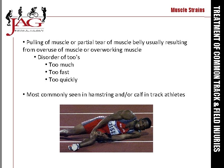  • Pulling of muscle or partial tear of muscle belly usually resulting from