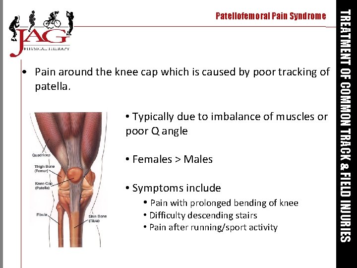  • Pain around the knee cap which is caused by poor tracking of