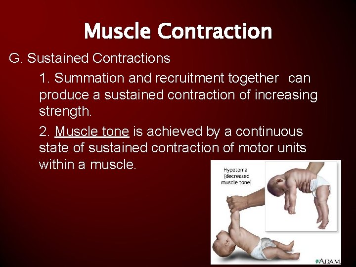 Muscle Contraction G. Sustained Contractions 1. Summation and recruitment together can produce a sustained