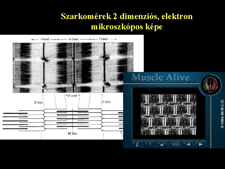 Szarkomérek 2 dimenziós, elektron mikroszkópos képe 