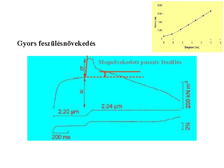 Gyors feszülésnövekedés Megnövekedett passzív feszülés 