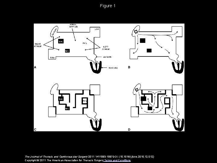 Figure 1 The Journal of Thoracic and Cardiovascular Surgery 2011 1411093 -1097 DOI: (10.