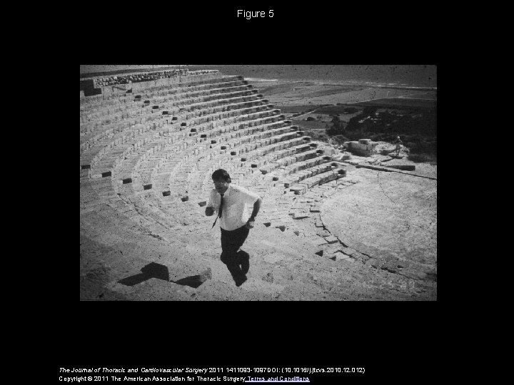 Figure 5 The Journal of Thoracic and Cardiovascular Surgery 2011 1411093 -1097 DOI: (10.