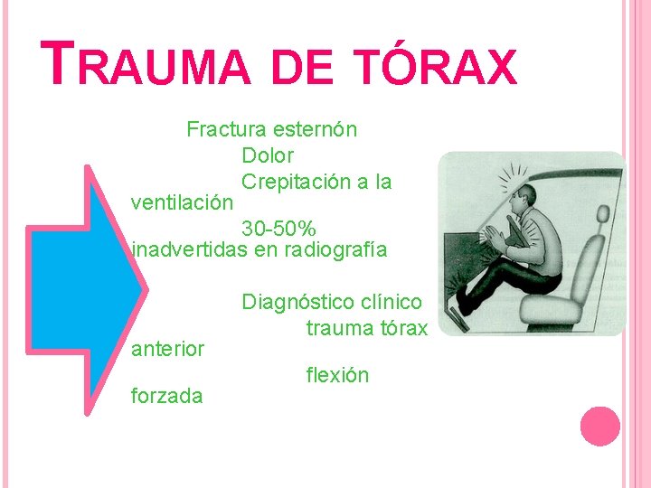 TRAUMA DE TÓRAX Fractura esternón Dolor Crepitación a la ventilación 30 -50% inadvertidas en