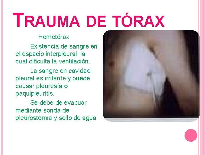 TRAUMA DE TÓRAX Hemotórax Existencia de sangre en el espacio interpleural, la cual dificulta
