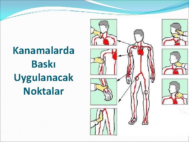 Kanamalarda Baskı Uygulanacak Noktalar 