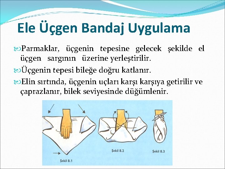Ele Üçgen Bandaj Uygulama Parmaklar, üçgenin tepesine gelecek şekilde el üçgen sargının üzerine yerleştirilir.