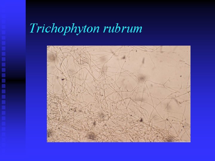 Trichophyton rubrum 