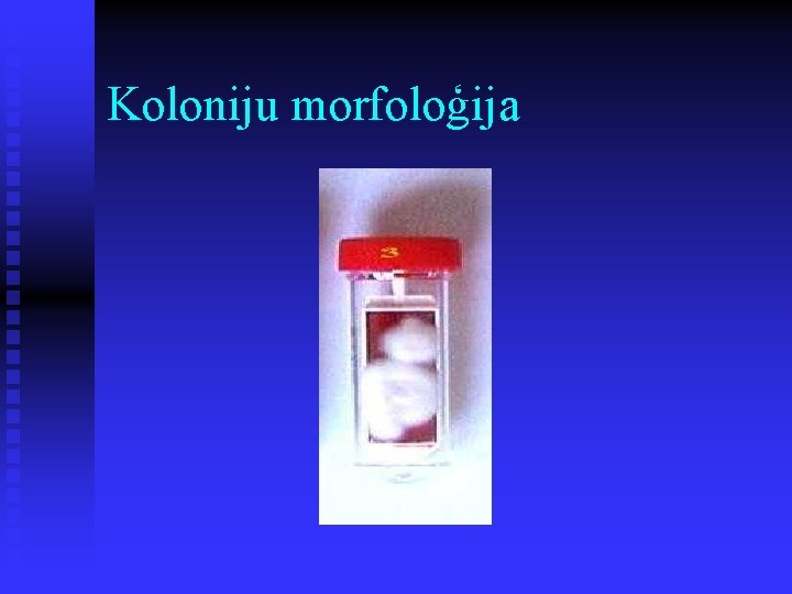 Koloniju morfoloģija 
