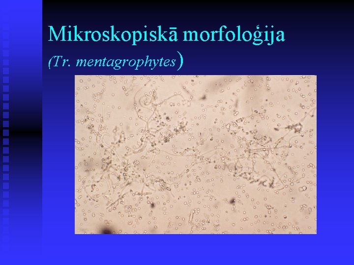 Mikroskopiskā morfoloģija (Tr. mentagrophytes) 
