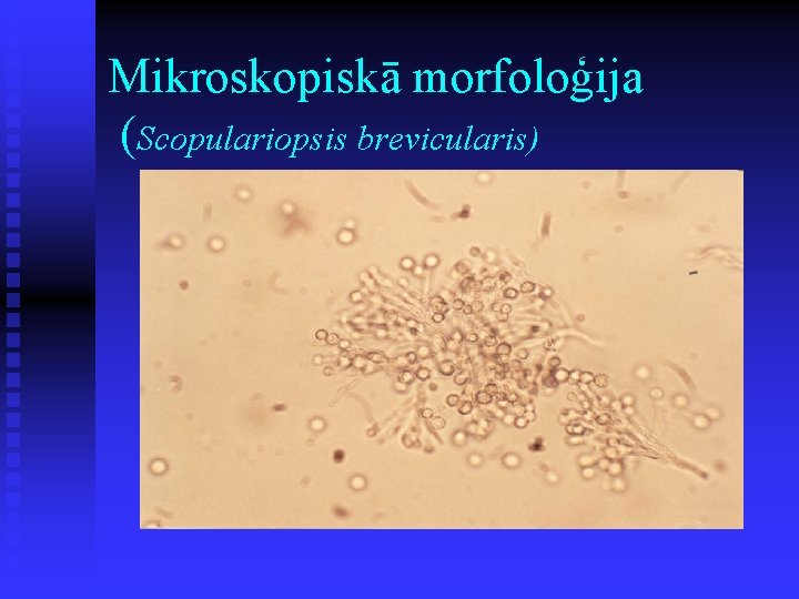 Mikroskopiskā morfoloģija (Scopulariopsis brevicularis) 