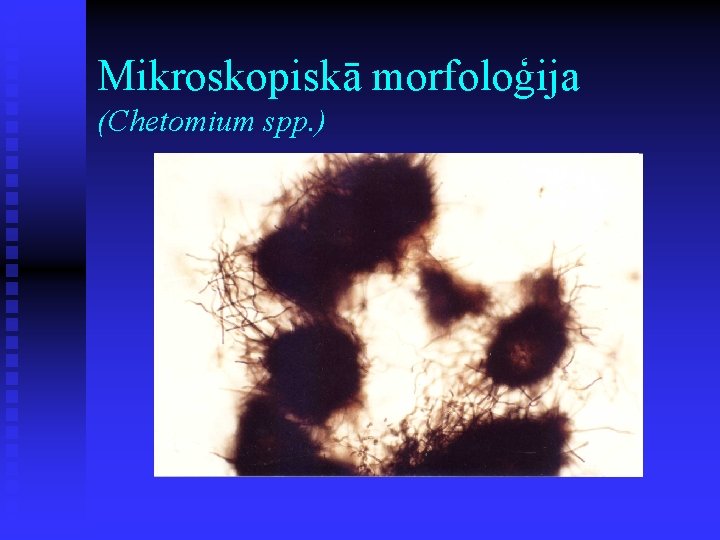 Mikroskopiskā morfoloģija (Chetomium spp. ) 