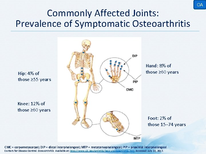 Commonly Affected Joints: Prevalence of Symptomatic Osteoarthritis Hip: 4% of those ≥ 55 years