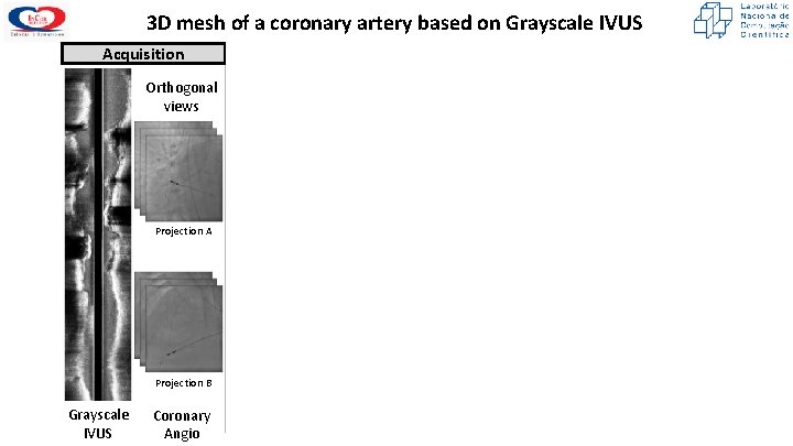 3 D mesh of a coronary artery based on Grayscale IVUS Acquisition Orthogonal views