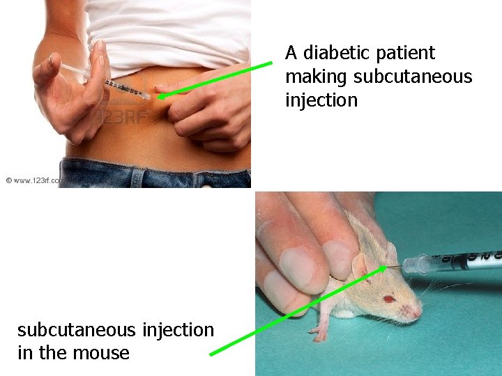 A diabetic patient making subcutaneous injection in the mouse 