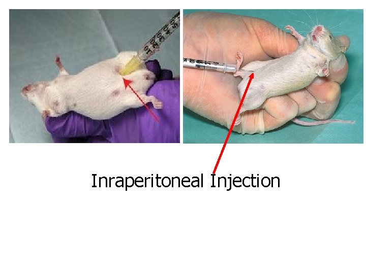 Inraperitoneal Injection 