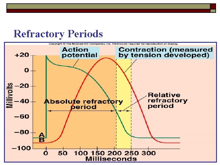 Refractory Periods 