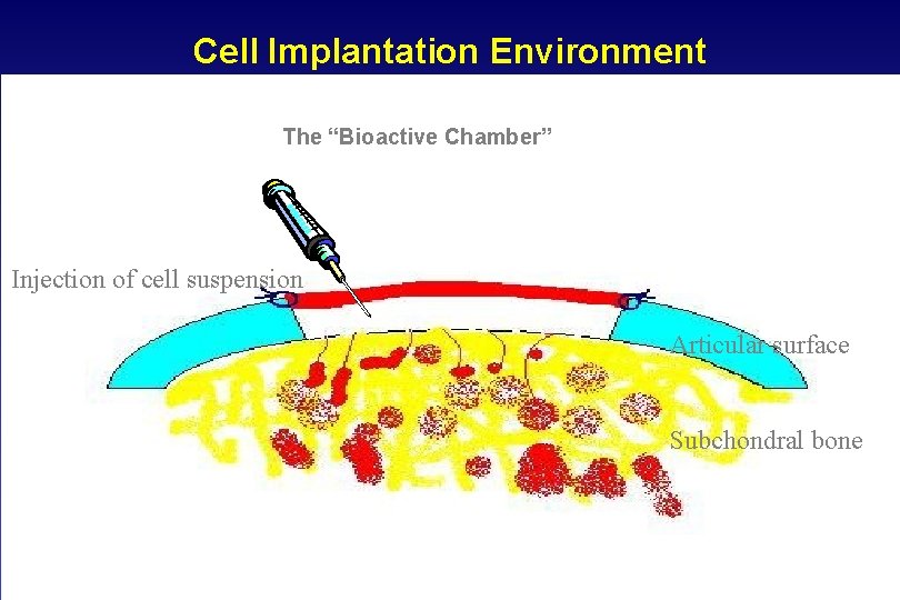 Cell Implantation Environment The “Bioactive Chamber” Injection of cell suspension Articular surface Subchondral bone