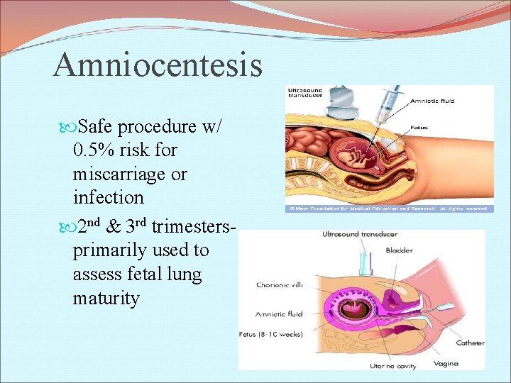 Amniocentesis Safe procedure w/ 0. 5% risk for miscarriage or infection 2 nd &