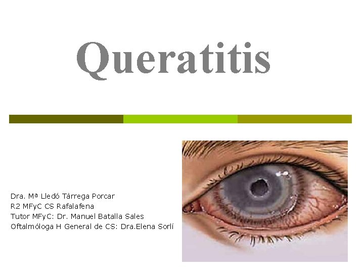 Queratitis Dra. Mª Lledó Tàrrega Porcar R 2 MFy. C CS Rafalafena Tutor MFy.