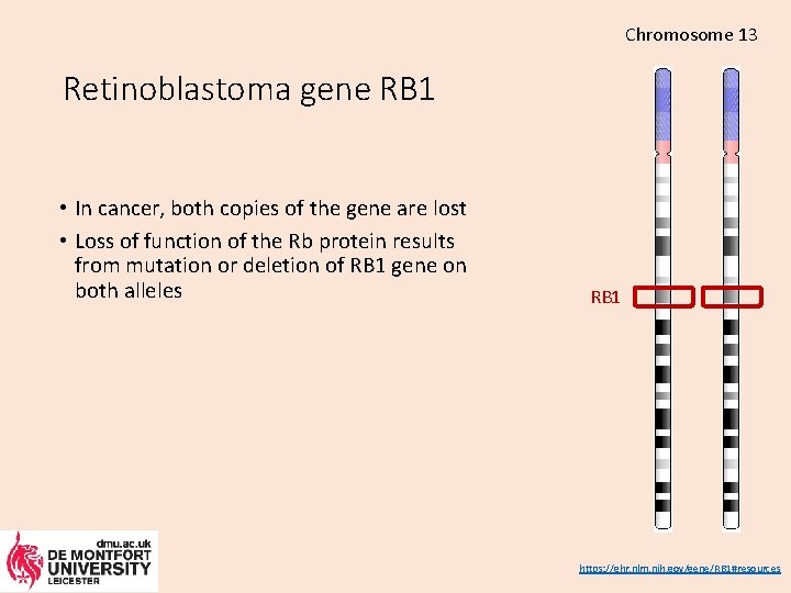 Chromosome 13 Retinoblastoma gene RB 1 • In cancer, both copies of the gene