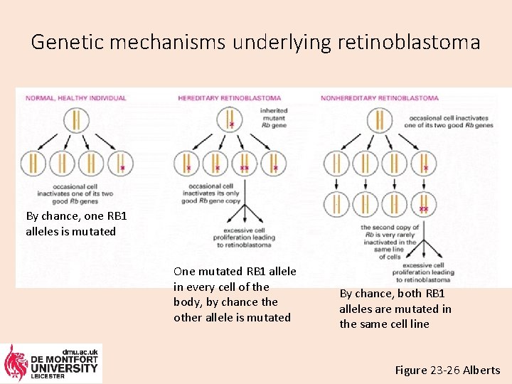 Genetic mechanisms underlying retinoblastoma By chance, one RB 1 alleles is mutated One mutated