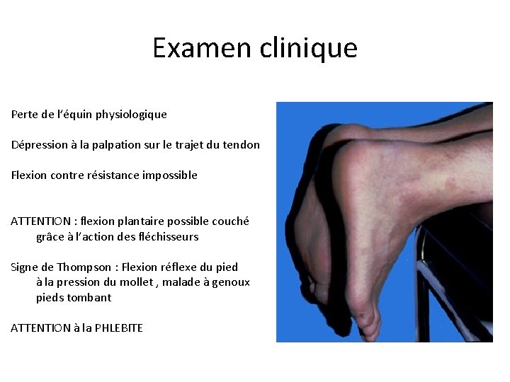 Examen clinique Perte de l’équin physiologique Dépression à la palpation sur le trajet du