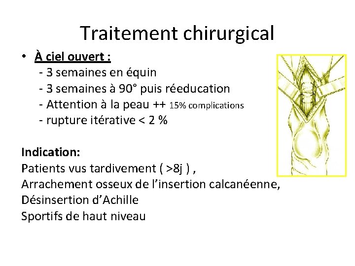 Traitement chirurgical • À ciel ouvert : - 3 semaines en équin - 3