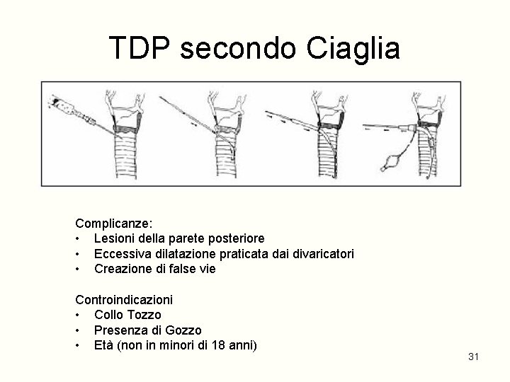 TDP secondo Ciaglia Complicanze: • Lesioni della parete posteriore • Eccessiva dilatazione praticata dai