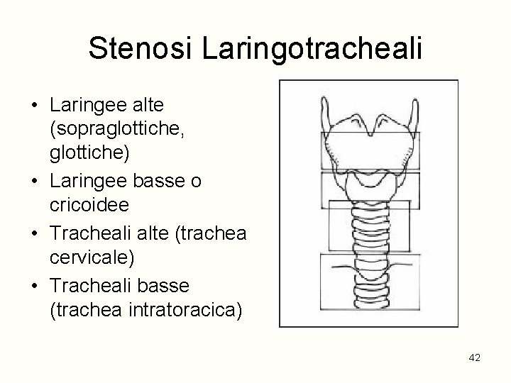 Stenosi Laringotracheali • Laringee alte (sopraglottiche, glottiche) • Laringee basse o cricoidee • Tracheali