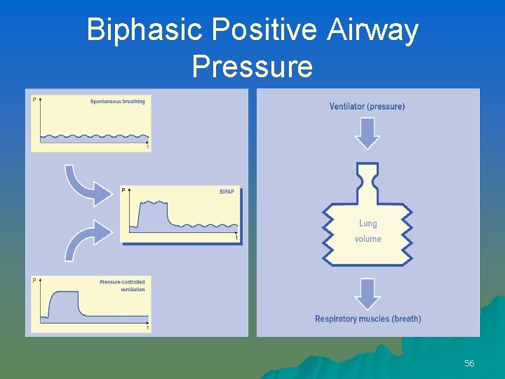 Biphasic Positive Airway Pressure 56 