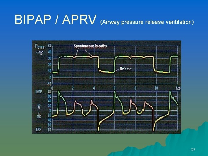 BIPAP / APRV (Airway pressure release ventilation) 57 