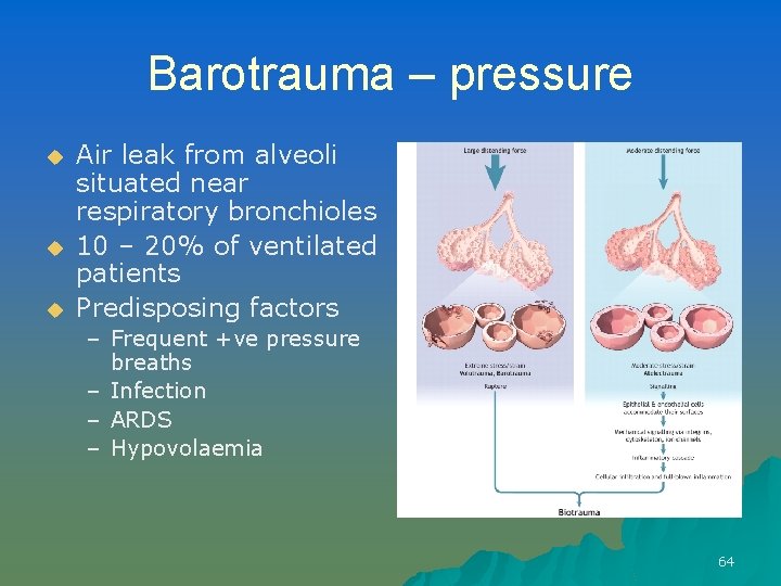 Barotrauma – pressure u u u Air leak from alveoli situated near respiratory bronchioles