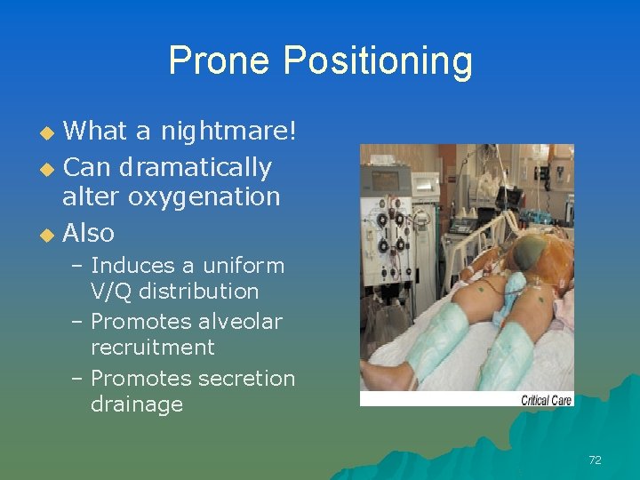 Prone Positioning What a nightmare! u Can dramatically alter oxygenation u Also u –