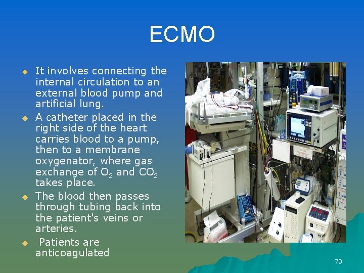 ECMO u u It involves connecting the internal circulation to an external blood pump