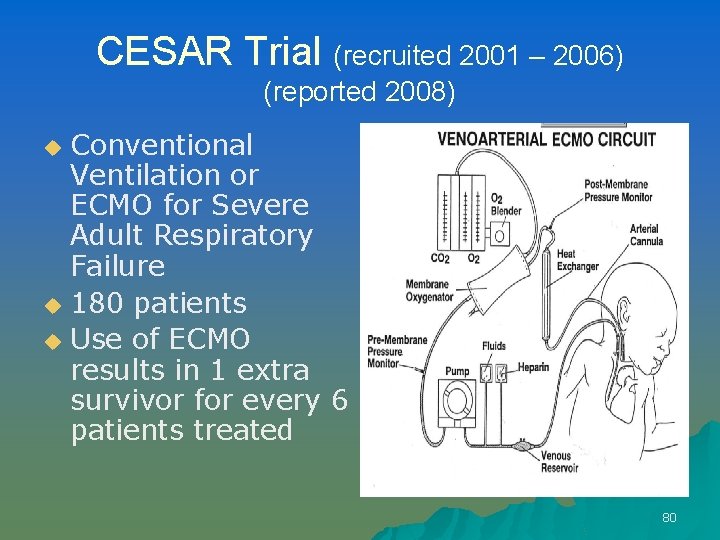 CESAR Trial (recruited 2001 – 2006) (reported 2008) Conventional Ventilation or ECMO for Severe