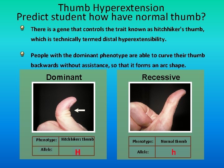 Thumb Hyperextension Predict student how have normal thumb? There is a gene that controls