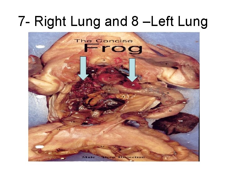 7 - Right Lung and 8 –Left Lung 