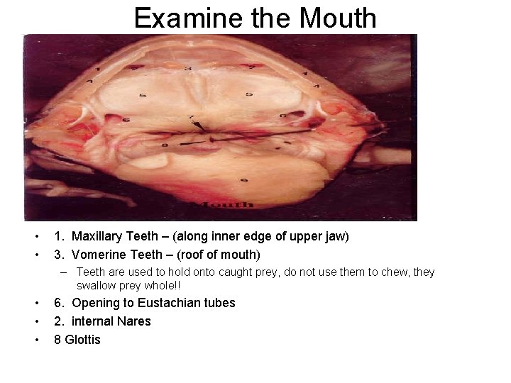 Examine the Mouth • • 1. Maxillary Teeth – (along inner edge of upper