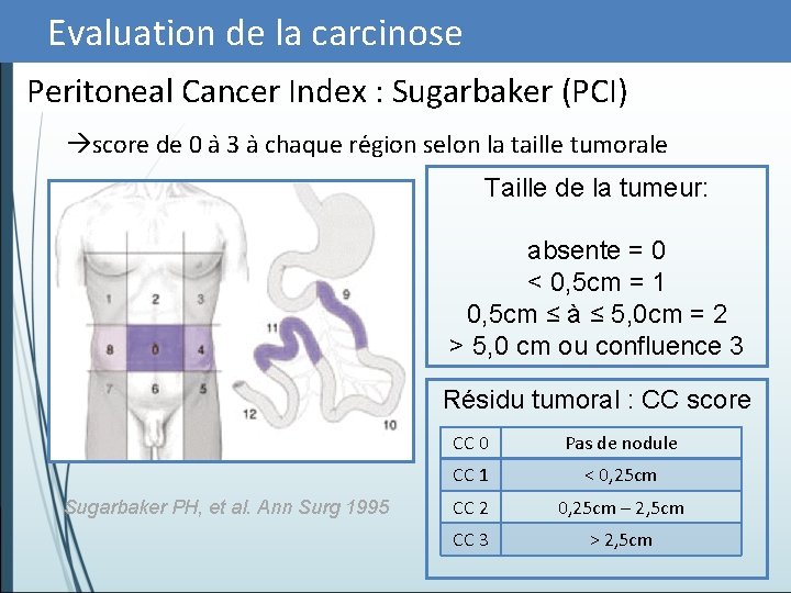 Evaluation de la carcinose Peritoneal Cancer Index : Sugarbaker (PCI) score de 0 a
