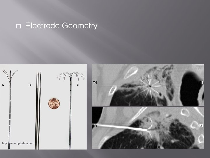 � Electrode Geometry http: //www. uptodate. com 